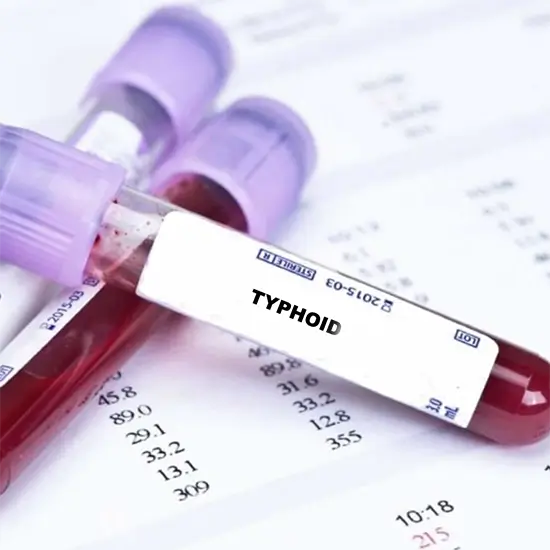 Typhidot IgM Rapid Card